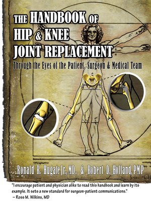 cover image of Handbook of Hip & Knee Joint Replacement